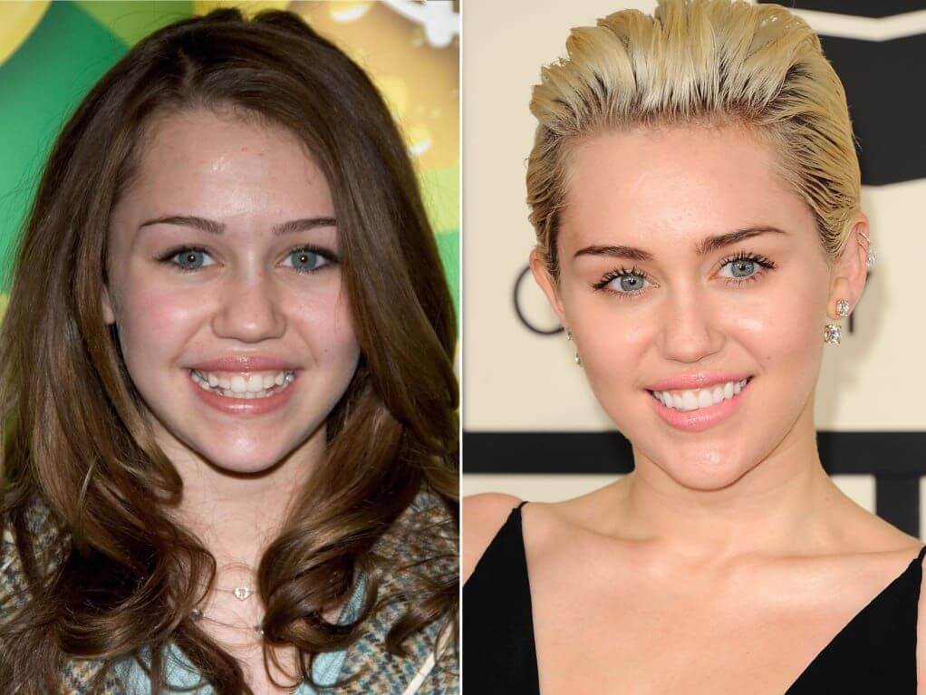 Miley Cyrus Plastic Surgery