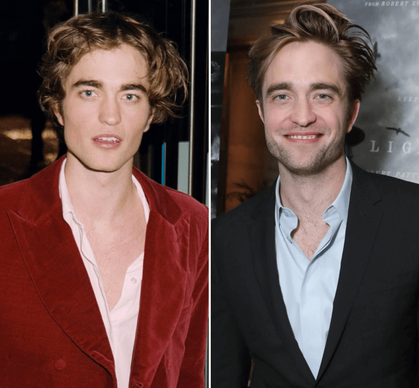 Robert Pattinson Before and After