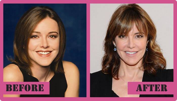 Christa Miller Before and After