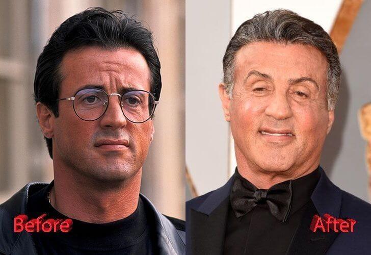 Sylvester Stallone Before and After
