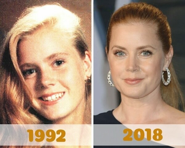 Amy Adams Before and After