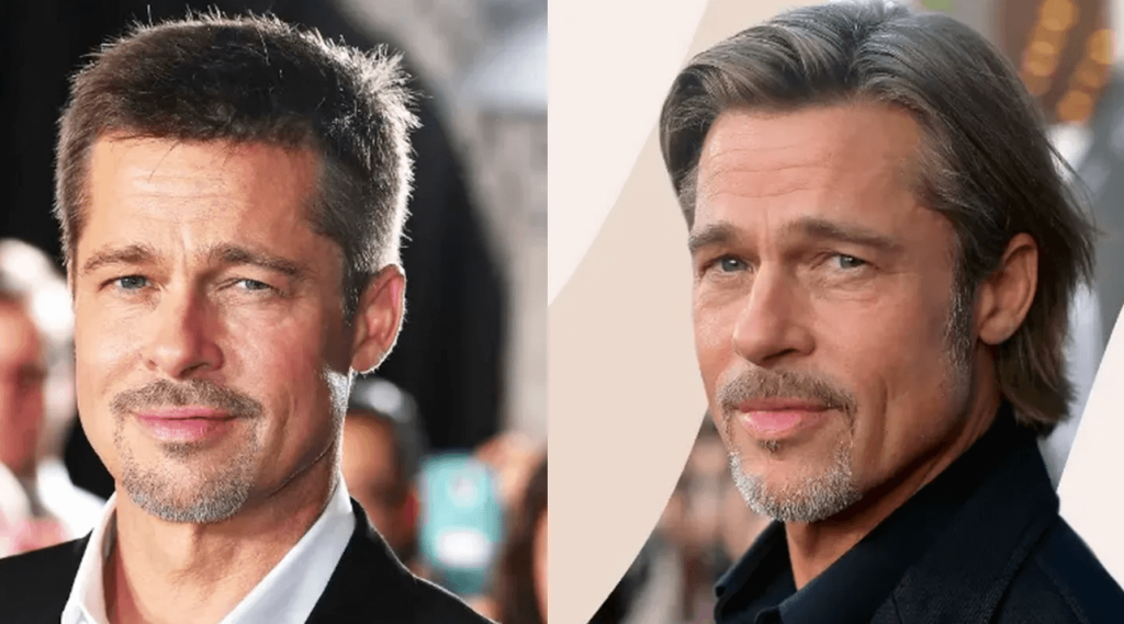 Brad Pitt Plastic Surgery: Before And After 