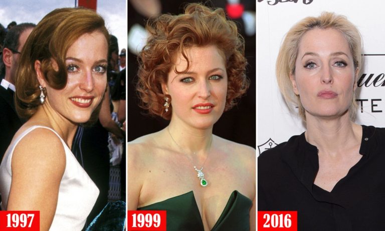 Gillian Anderson Plastic Surgery Before And After