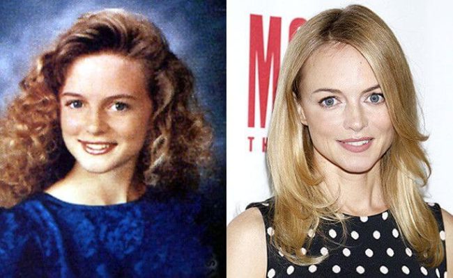 Heather Graham Plastic Surgery: Before & After 