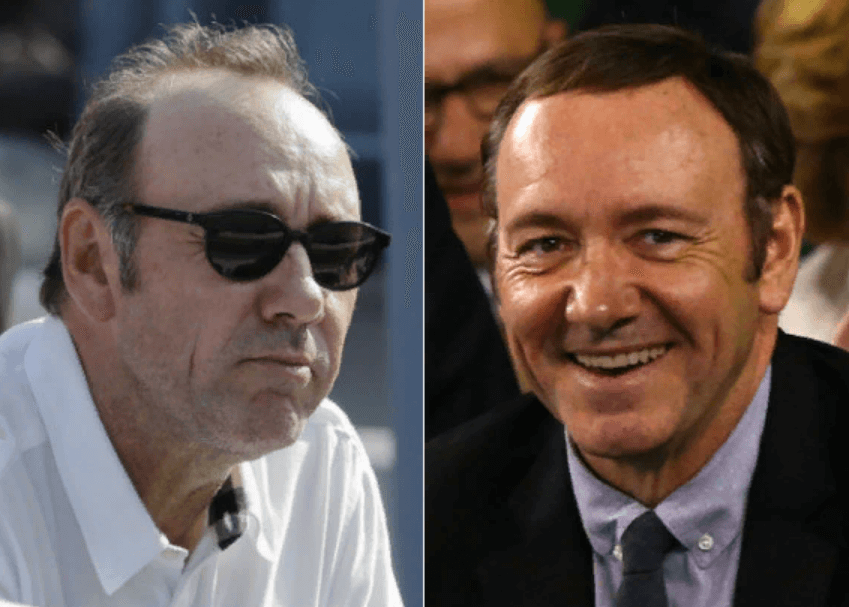 Kevin Spacey Before and After