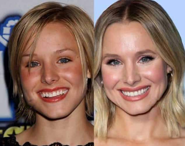 Kristen Bell Before and After