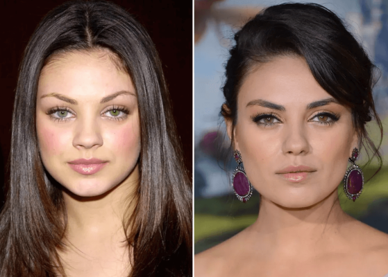 Mila Kunis Plastic Surgery: Then & Now | PlasticSurgeryInsights.com