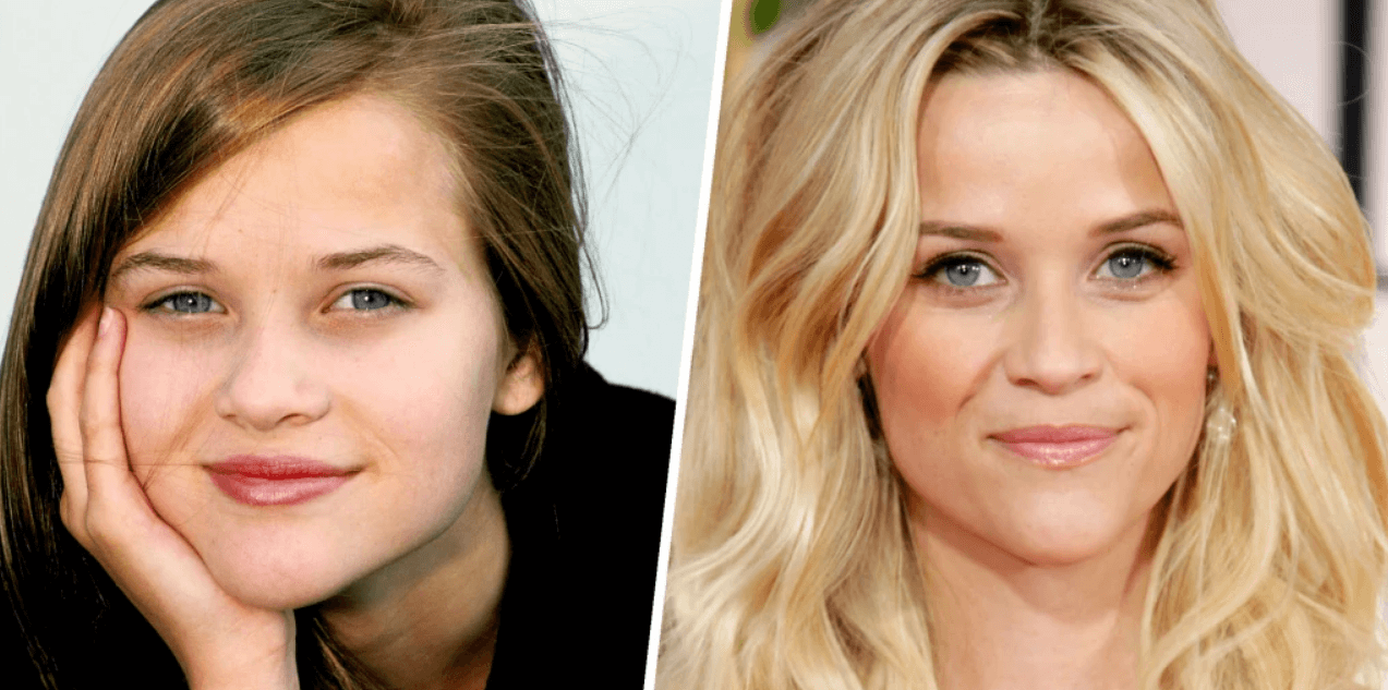 Reese Witherspoon Facelift