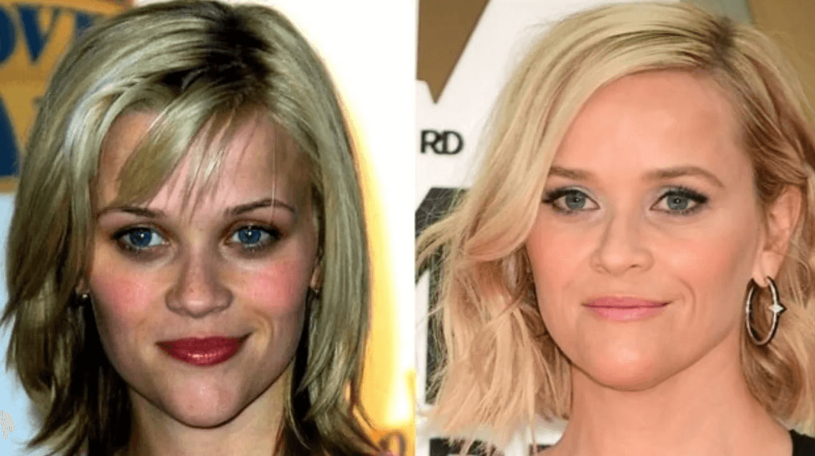 Reese Witherspoon Nose Job