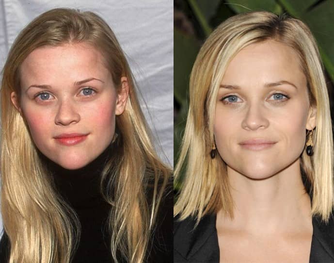 Reese Witherspoon Plastic Surgery