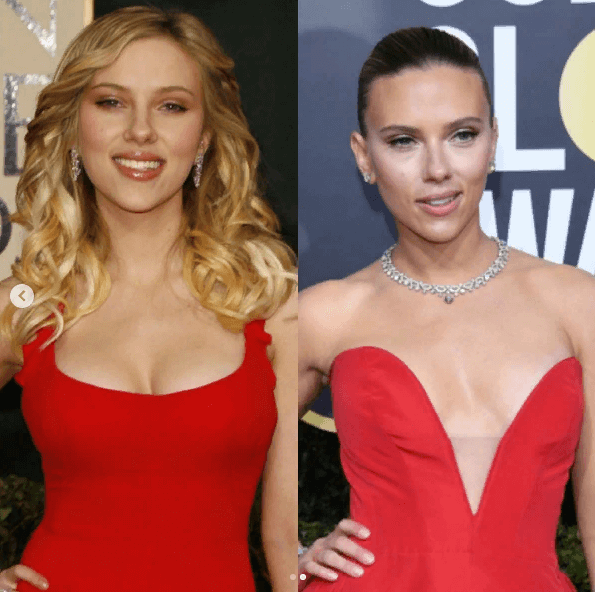 Scarlett Johansson Facelift