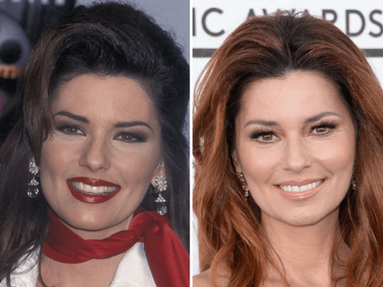 Shania Twain Plastic Surgery: A Candid Look | PlasticSurgeryInsights.com