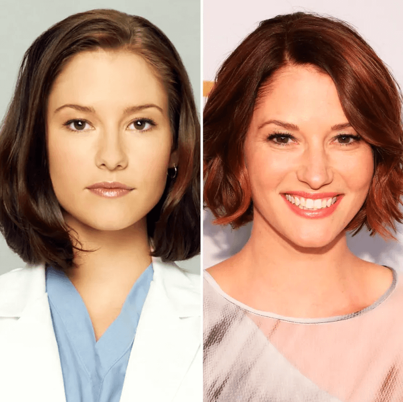 Chyler Leigh Lip Injection