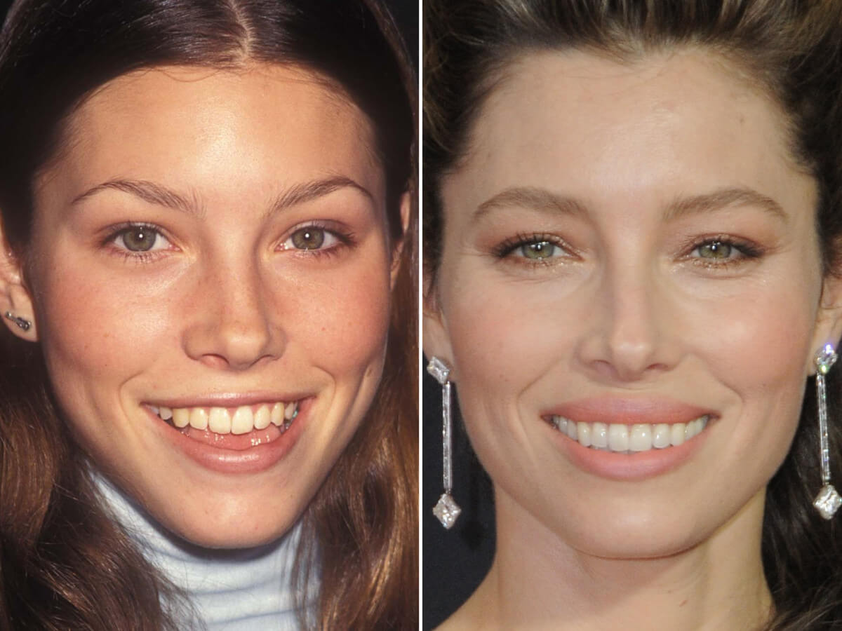 Jessica Biel Before and After