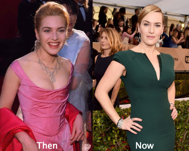 Kate Winslet Breast Augmentation