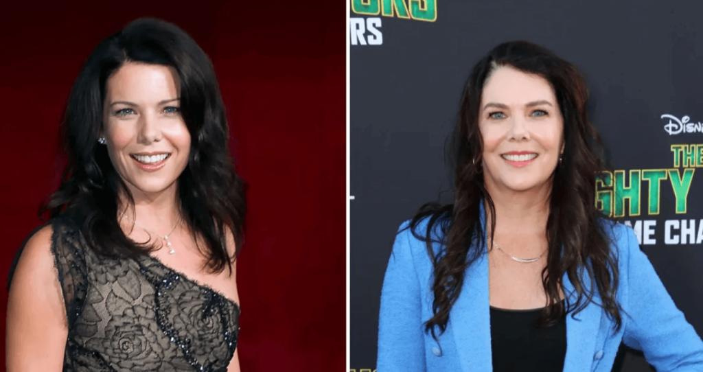 Lauren Graham Plastic Surgery: Before & After 