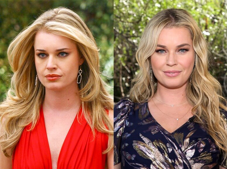 Rebecca Romijn Before and After