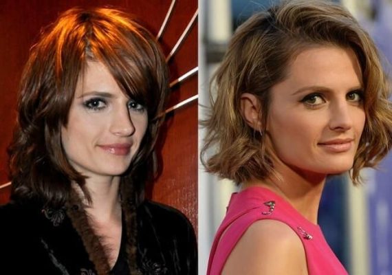 Stana Katic Plastic Surgery: Before & After Photos ...