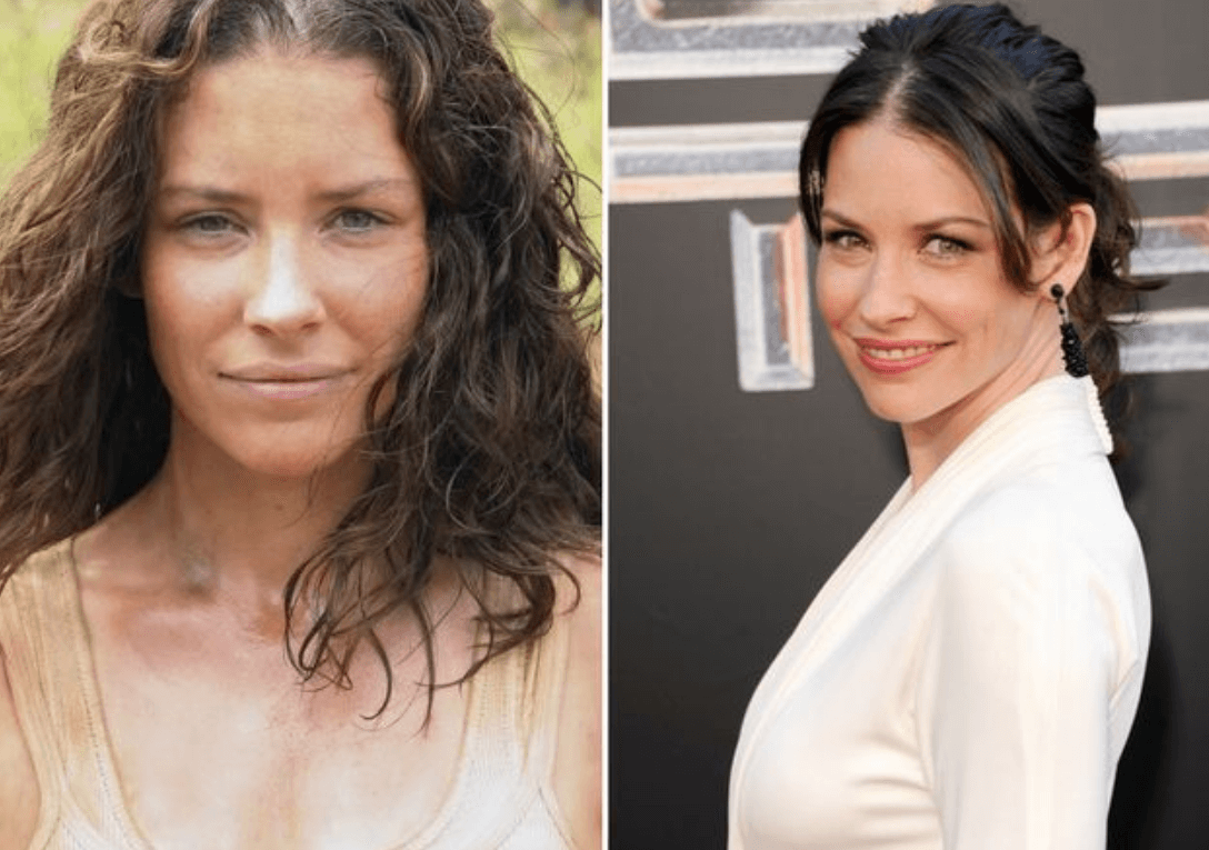 Evangeline Lilly Lip Injection