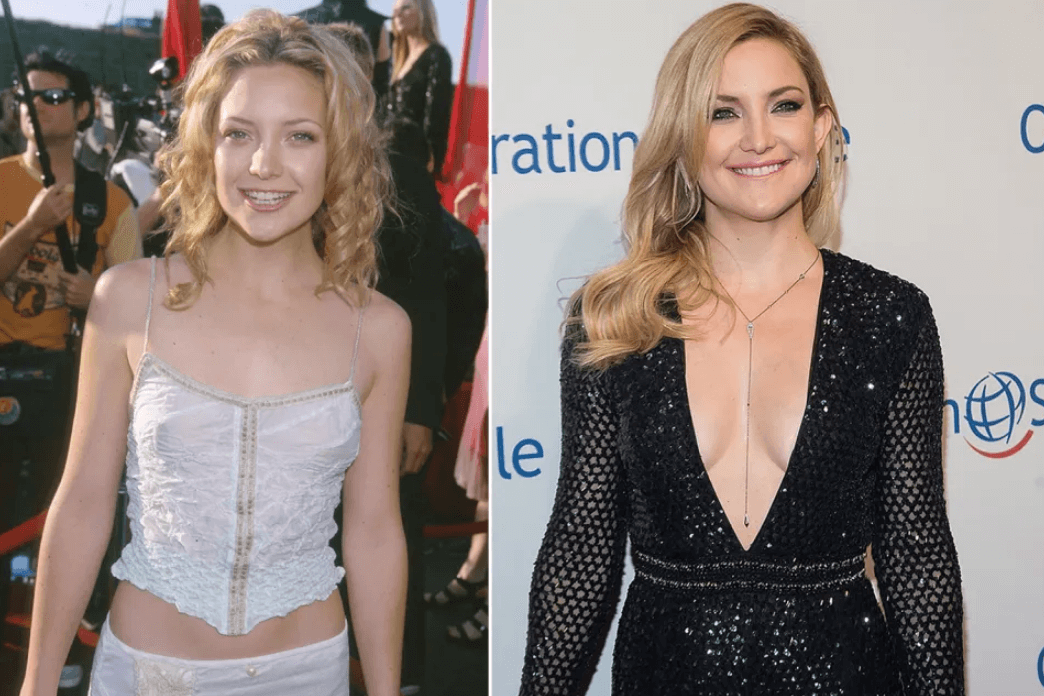 Kate Hudson Before and After