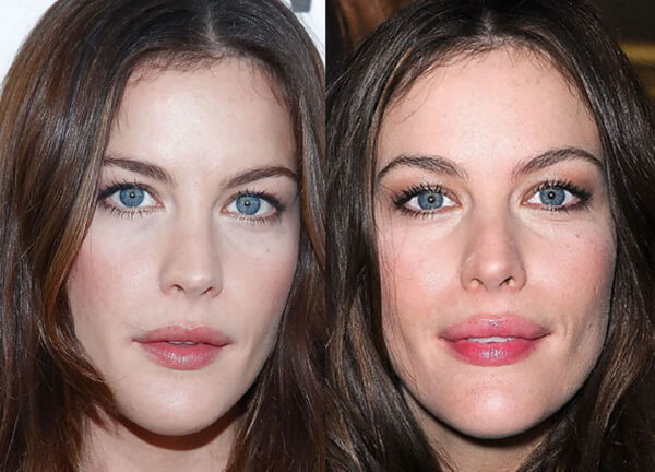 Liv Tyler Lip Injections