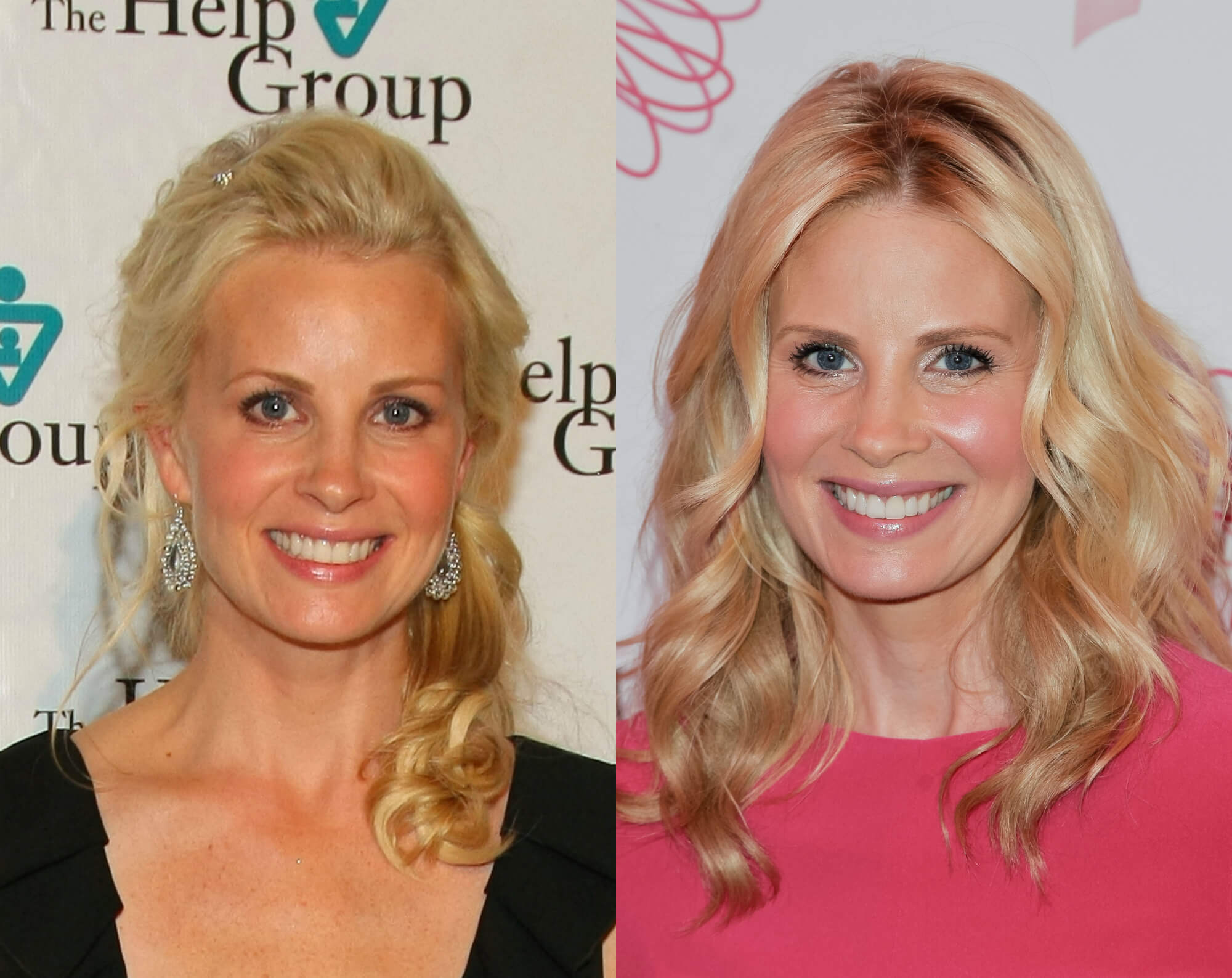 Monica Potter Cosmetic Surgery