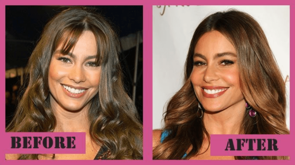 Sofía Vergara Plastic Surgery: Before & After | PlasticSurgeryInsights.com