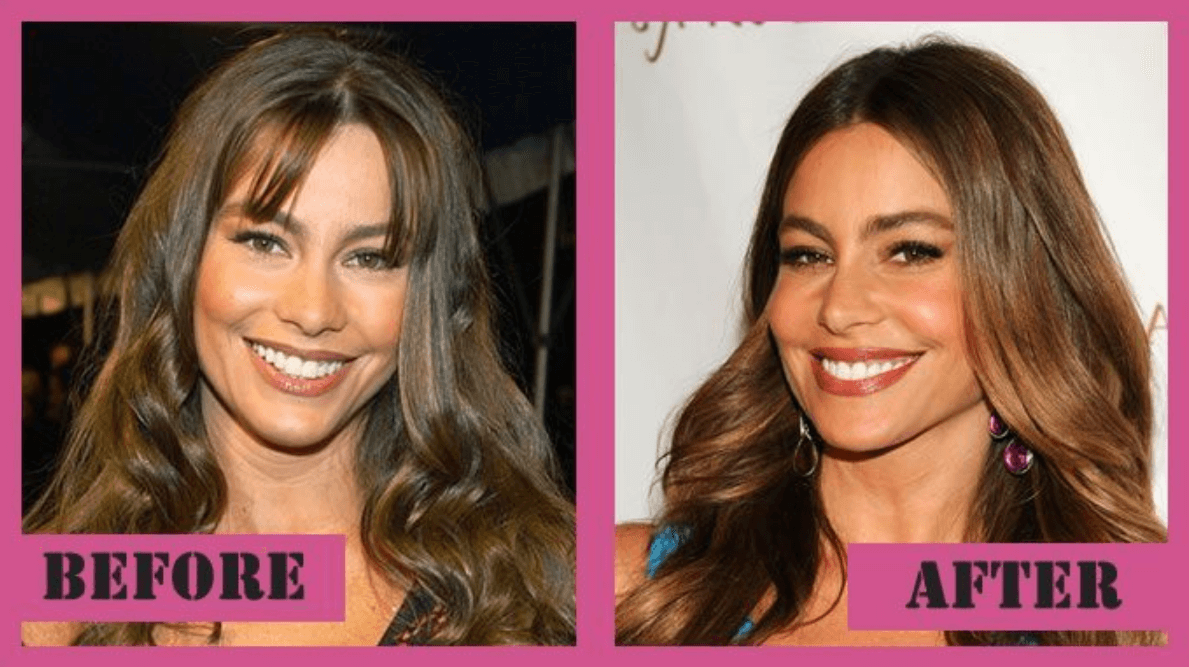 Sofía Vergara Before and After