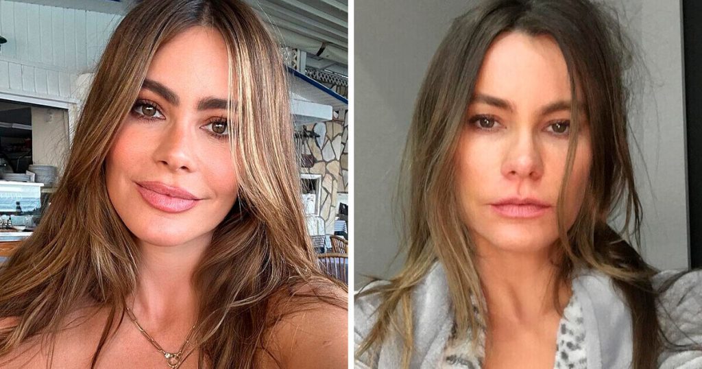 Sofía Vergara Plastic Surgery: Before & After | PlasticSurgeryInsights.com