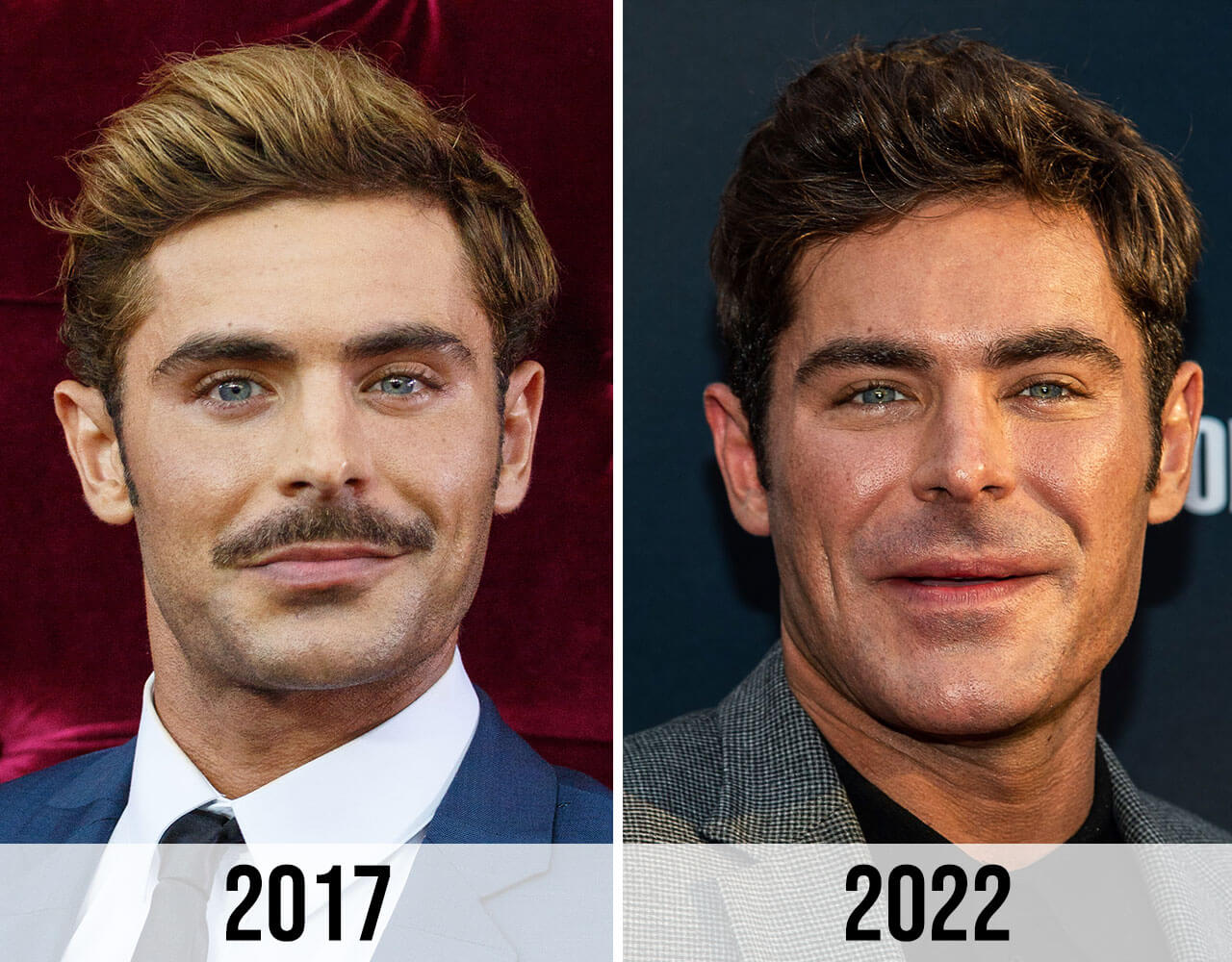 Zac Efron Plastic Surgery Before and After