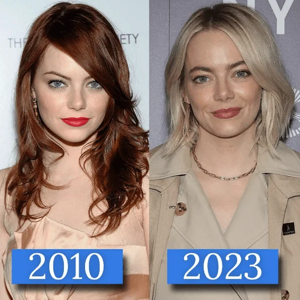 Emma Stone Before and After