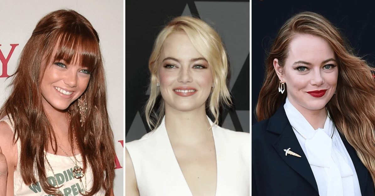 Emma Stone Plastic Surgery