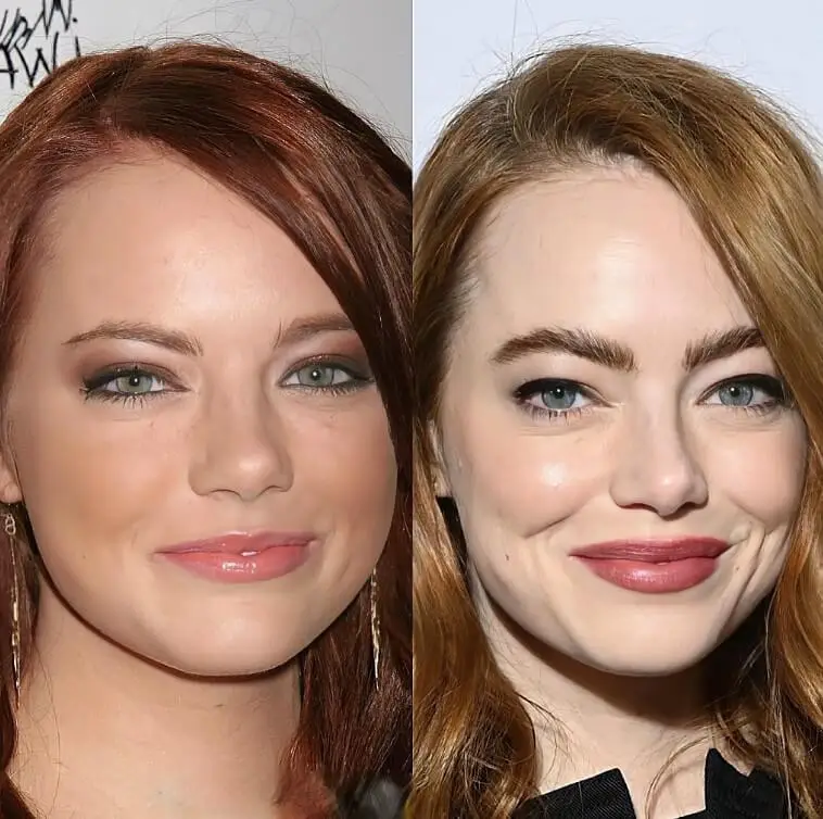 Emma Stone Then and Now