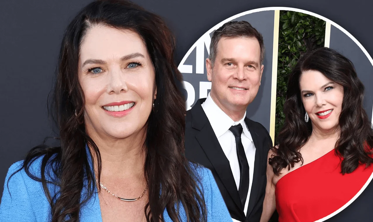 Lauren Graham Cosmetic Surgery