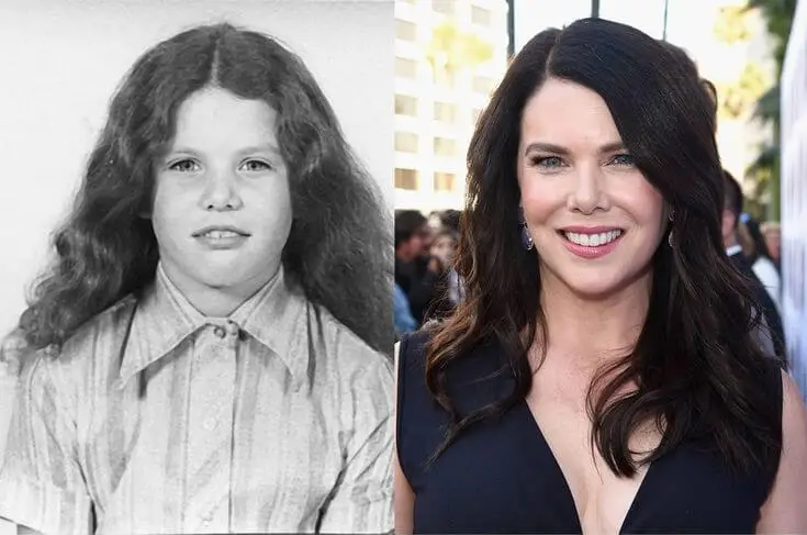 Lauren Graham Plastic Surgery