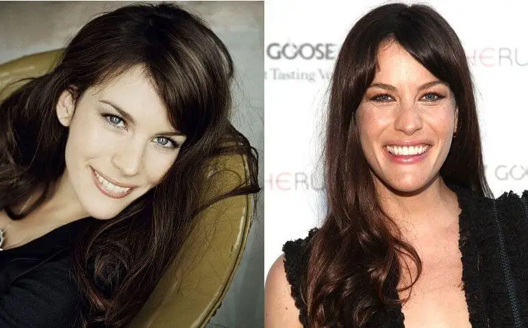 Liv Tyler Botox