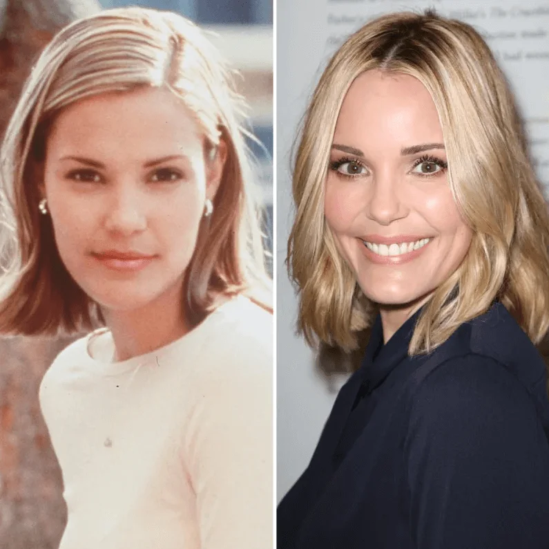 Leslie Bibb Plastic Surgery