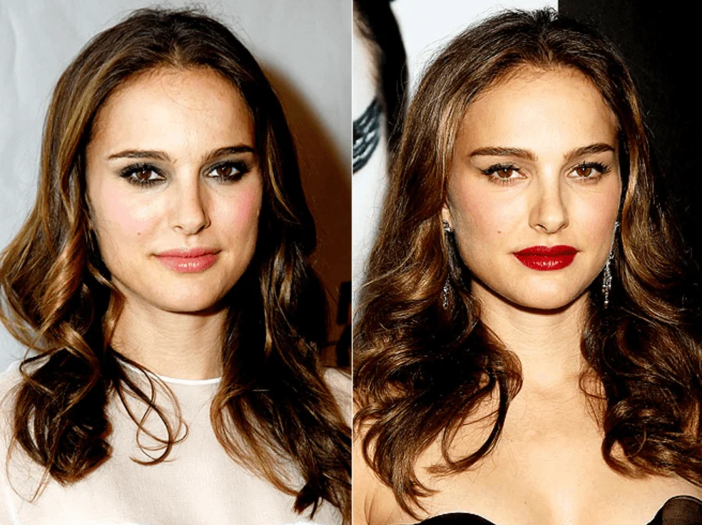 Natalie Portman Skin Treatments