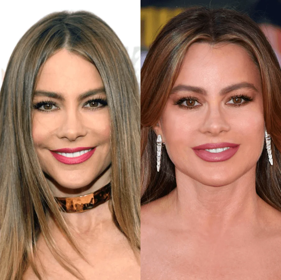 Sofía Vergara Plastic Surgery: Before & After | PlasticSurgeryInsights.com